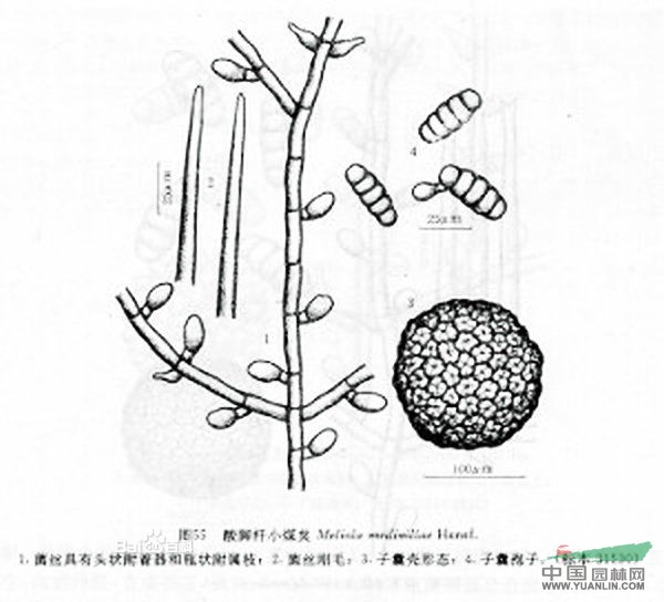 滇酸腳桿 